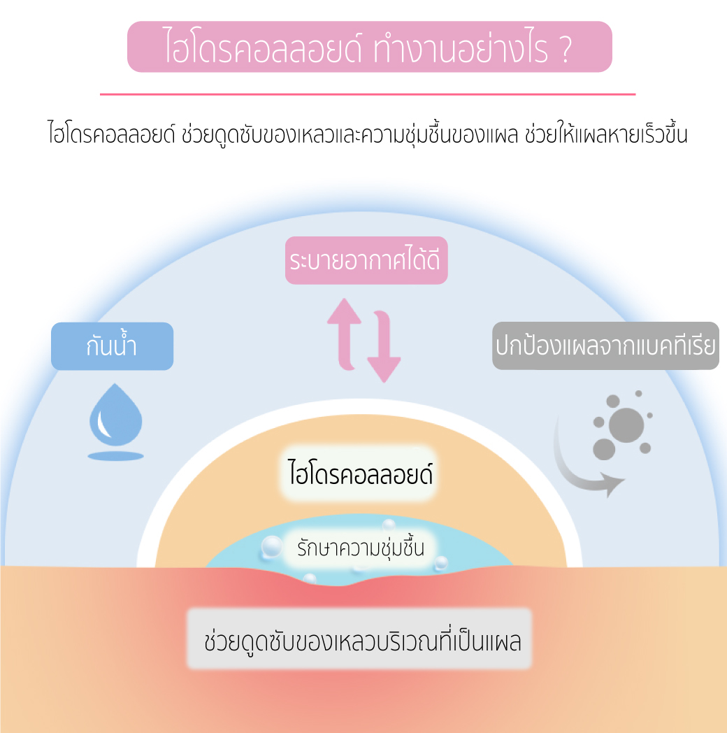 แผ่นรองกันกัด
